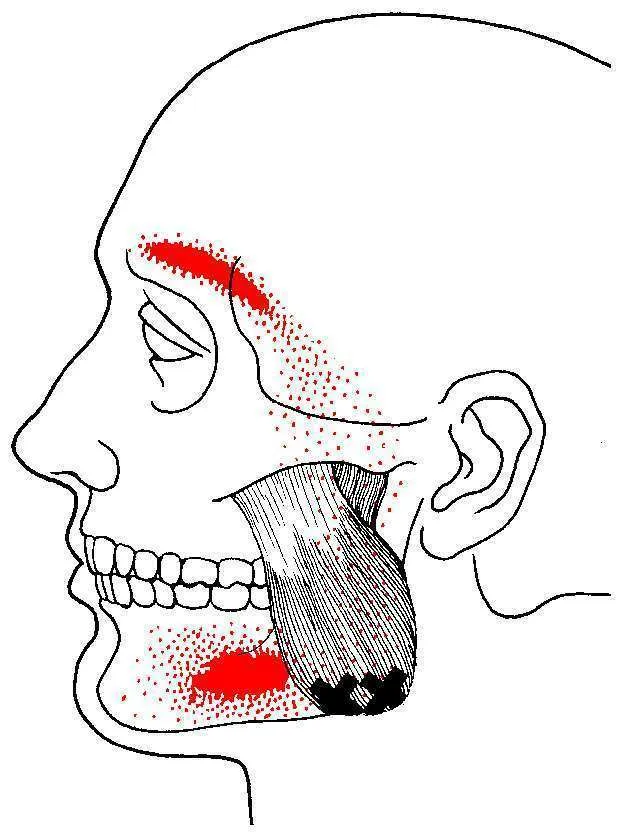 TMJ Self Massage: Massaging Your Masseter Muscle | Restorative Health ...